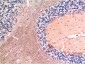 TGFβ1 mouse Monoclonal Antibody(5D2)